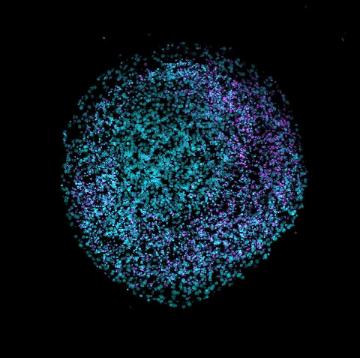 A fluorescent microscopy image of a brain organoid, a three-dimensional cluster of neural cells grown from stem cells in a dish. Image from Wikimedia Commons, CC BY-SA 4.0.